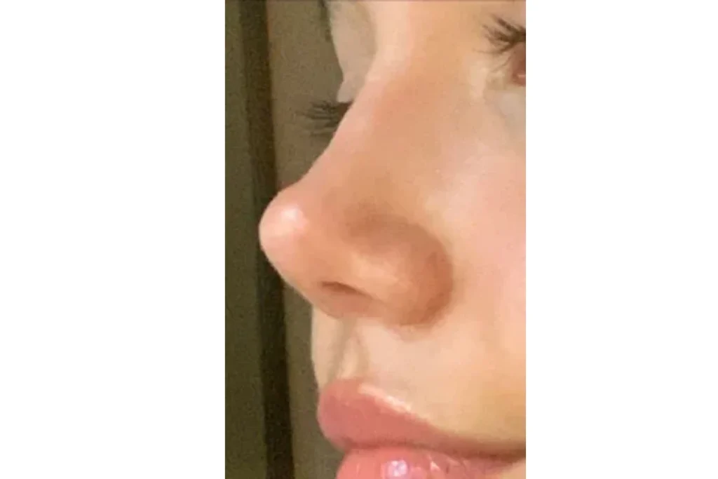 spiritual-meanings-of-nose-twitching