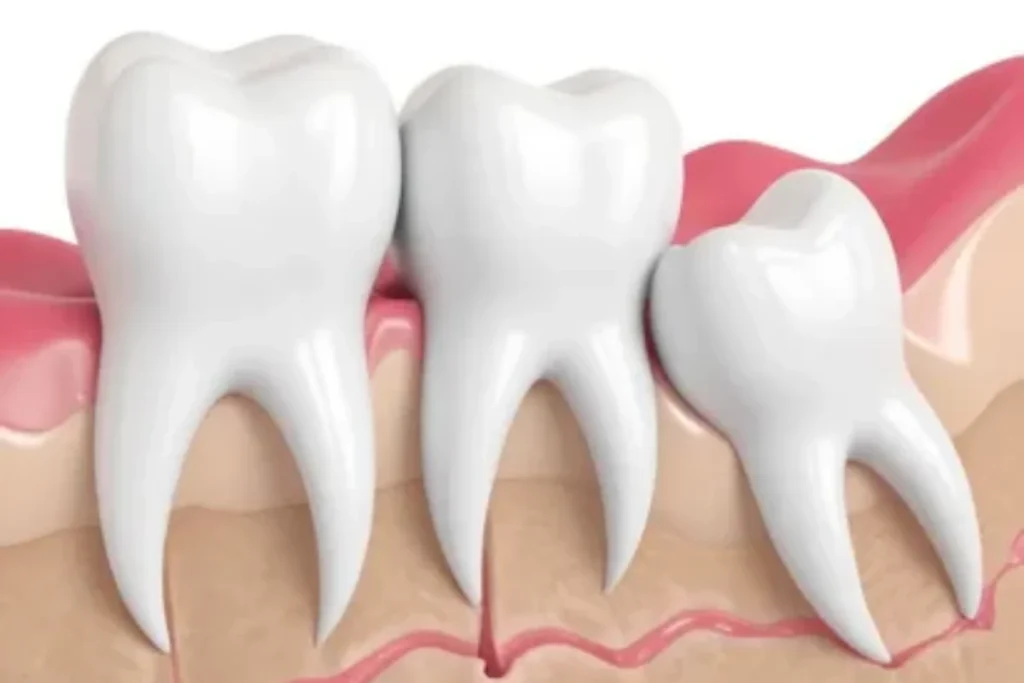 hidden-benefits-of-keeping-your-wisdom-teeth