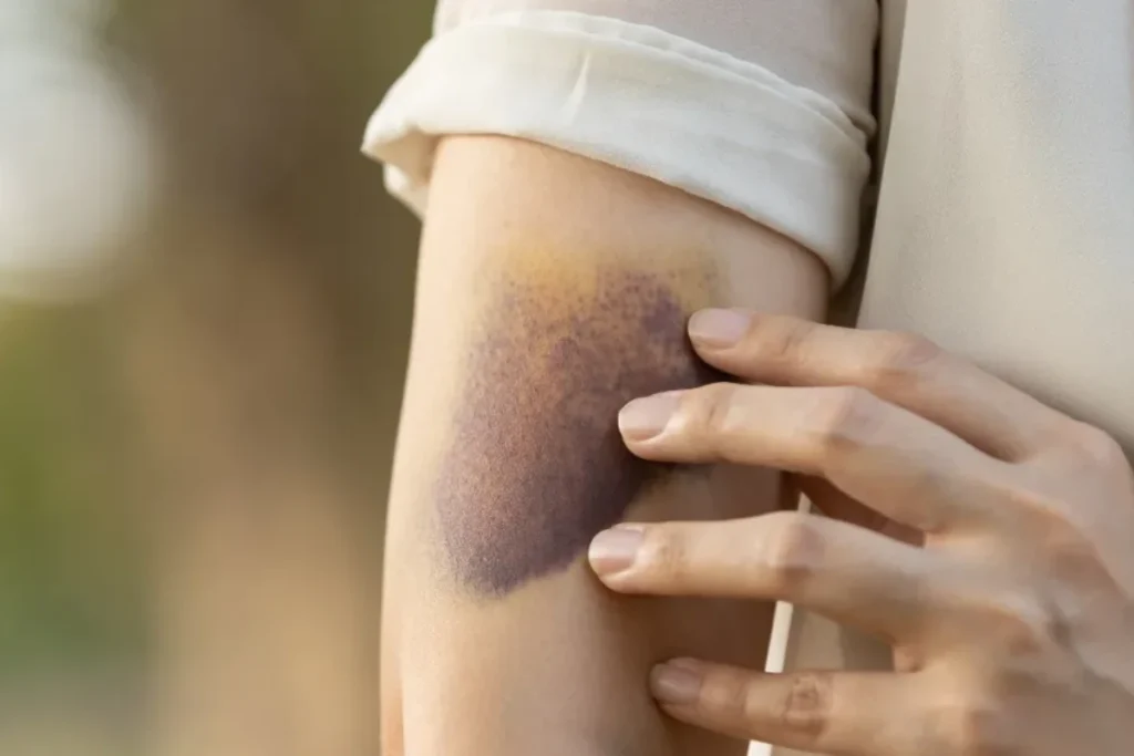 what-are-spiritual-bruises